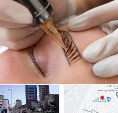 میکروبلیدینگ در چهارراه طالقانی کرج