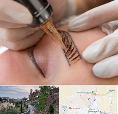 میکروبلیدینگ در باغستان کرج