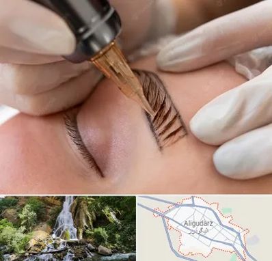 میکروبلیدینگ در الیگودرز