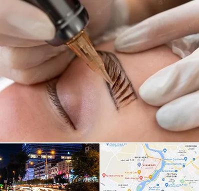 میکروبلیدینگ در کیانپارس اهواز