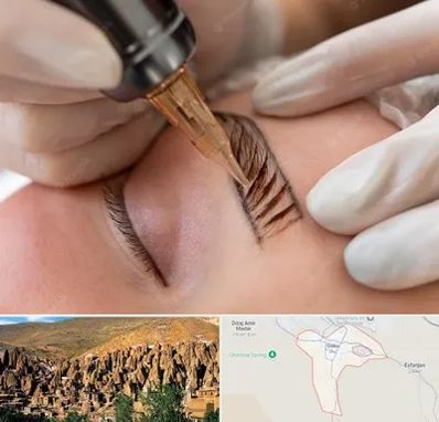 میکروبلیدینگ در اسکو