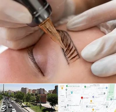 میکروبلیدینگ در شهرک آزمایش