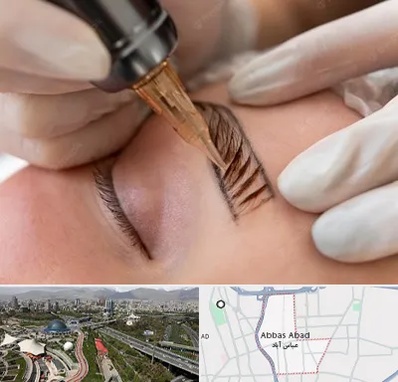 میکروبلیدینگ در عباس آباد تهران