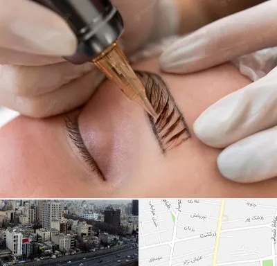 میکروبلیدینگ در زرتشت