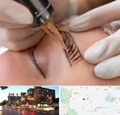 میکروبلیدینگ در بلوار سجاد مشهد