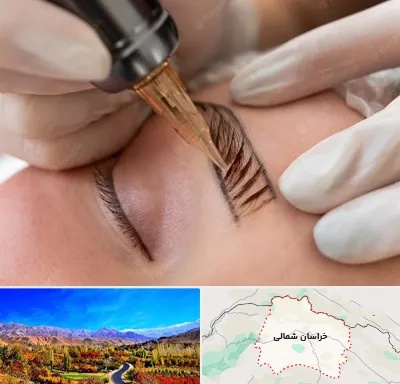 میکروبلیدینگ در خراسان شمالی