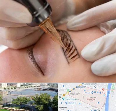 میکروبلیدینگ در گلستان اهواز