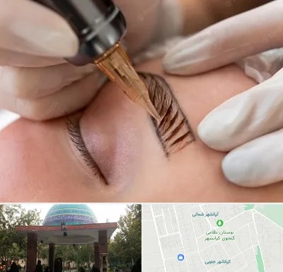 میکروبلیدینگ در کیانشهر