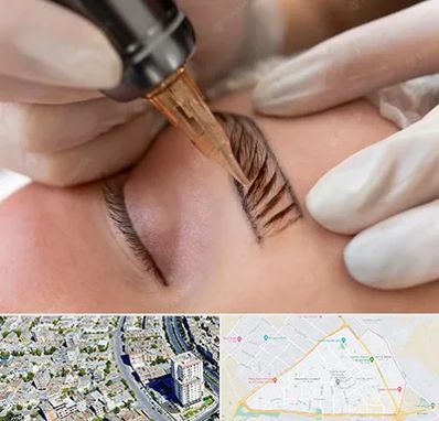 میکروبلیدینگ در قاسم آباد مشهد