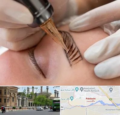 میکروبلیدینگ در پاکدشت