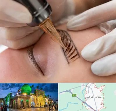 میکروبلیدینگ در آستانه اشرفیه