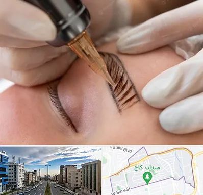 میکروبلیدینگ در سعادت آباد تهران