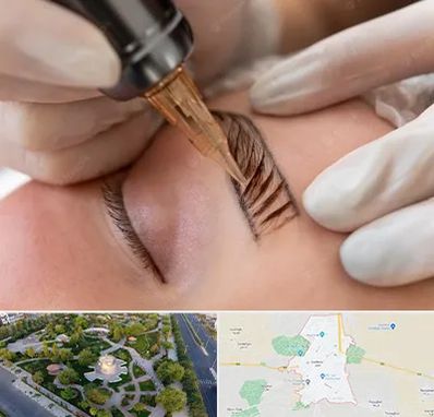 میکروبلیدینگ در کاشمر