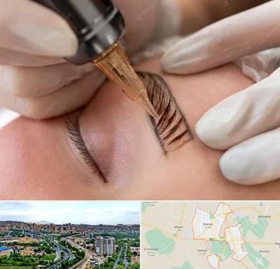 میکروبلیدینگ در شهریار