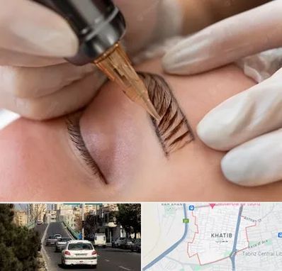 میکروبلیدینگ در خطیب تبریز