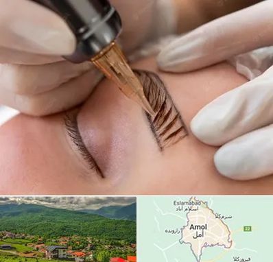 میکروبلیدینگ در آمل