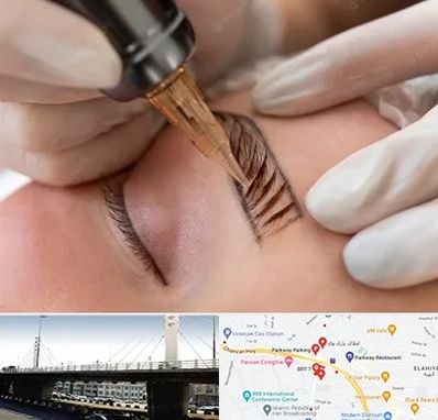 میکروبلیدینگ در پارک وی