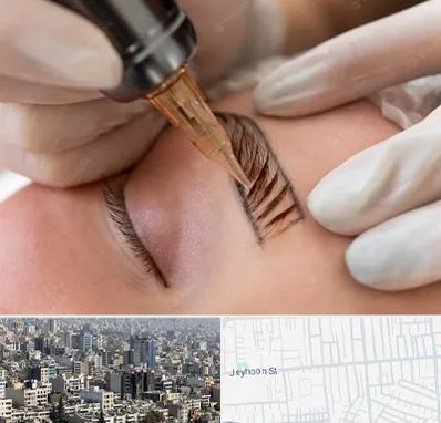 میکروبلیدینگ در جیحون