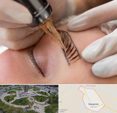 میکروبلیدینگ در ورامین