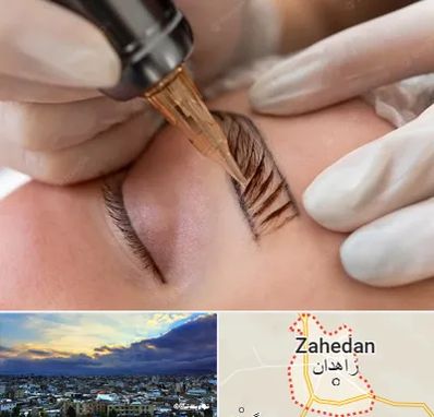 میکروبلیدینگ در زاهدان