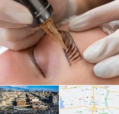 میکروبلیدینگ در شهرک راه آهن