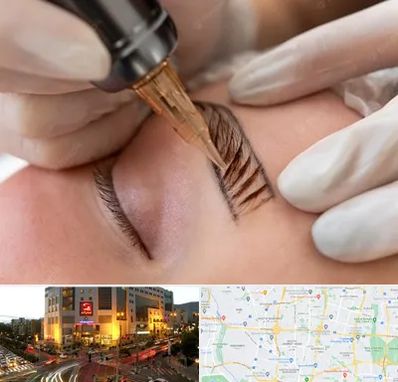 میکروبلیدینگ در جنت آباد تهران