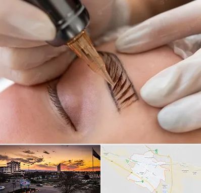 میکروبلیدینگ در قوچان