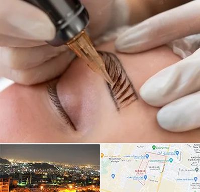 میکروبلیدینگ در مارلیک کرج