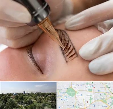 میکروبلیدینگ در منطقه 16 تهران