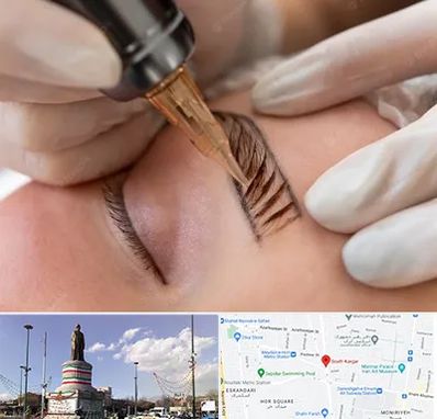 میکروبلیدینگ در کارگر جنوبی