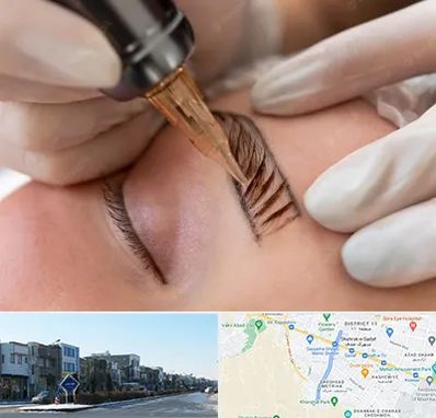 میکروبلیدینگ در شریعتی مشهد