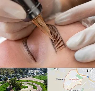 میکروبلیدینگ در مهرشهر کرج