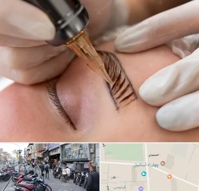 میکروبلیدینگ در چهارراه استانبول
