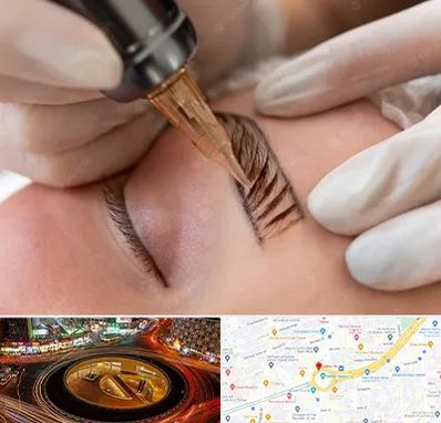 میکروبلیدینگ در میدان ولیعصر