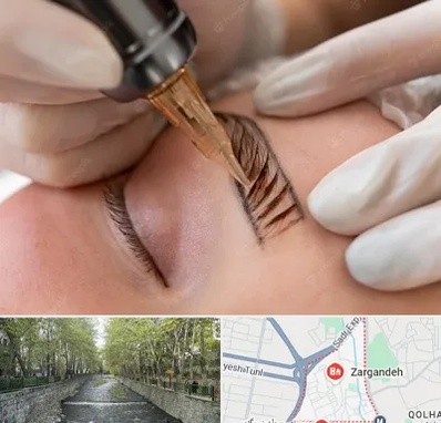 میکروبلیدینگ در زرگنده