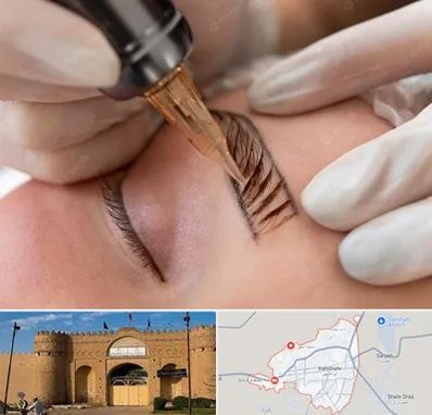 میکروبلیدینگ در ایرانشهر