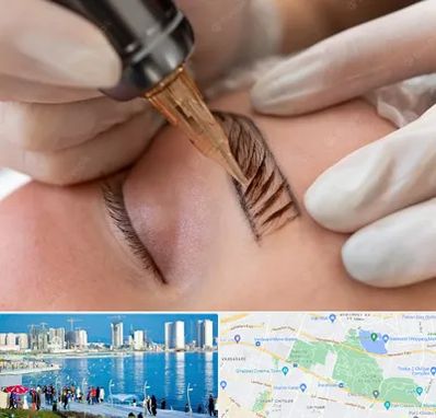 میکروبلیدینگ در چیتگر