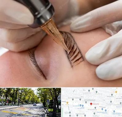 میکروبلیدینگ در میرداماد