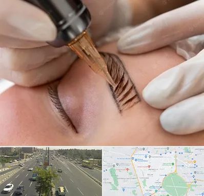 میکروبلیدینگ در منطقه 17 تهران