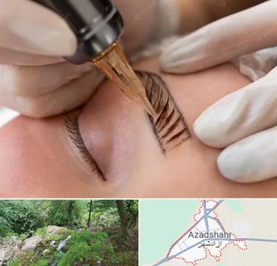 میکروبلیدینگ در آزادشهر