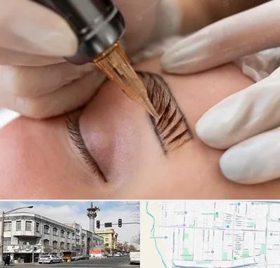 میکروبلیدینگ در 17شهریور