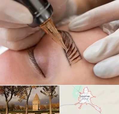 میکروبلیدینگ در تویسرکان