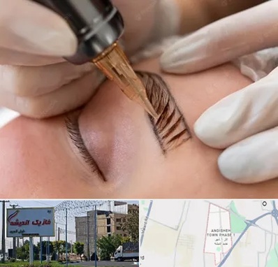 میکروبلیدینگ در فاز یک اندیشه
