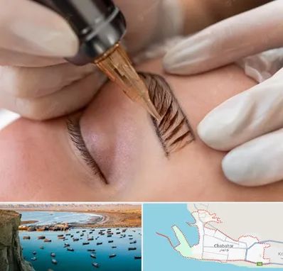 میکروبلیدینگ در چابهار
