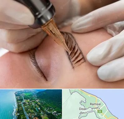 میکروبلیدینگ در رامسر
