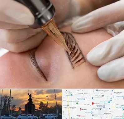 میکروبلیدینگ در میدان حر