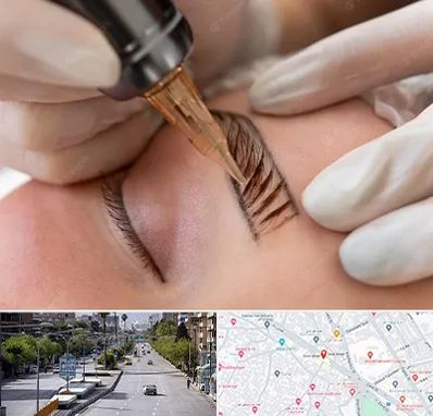 میکروبلیدینگ در خیابان زند شیراز