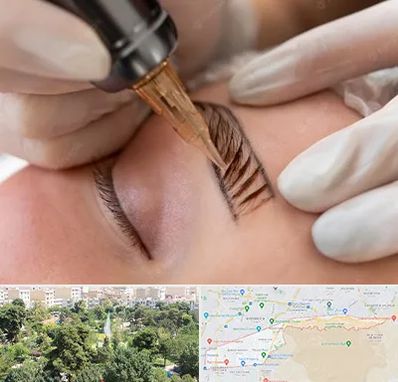 میکروبلیدینگ در منطقه 13 تهران