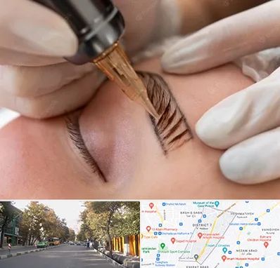 میکروبلیدینگ در شریعتی