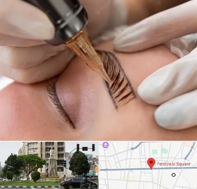 میکروبلیدینگ در میدان فردوسی تهران